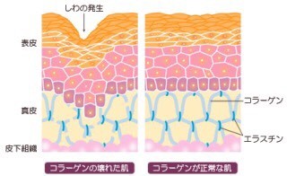 コラーゲンやエラスチン