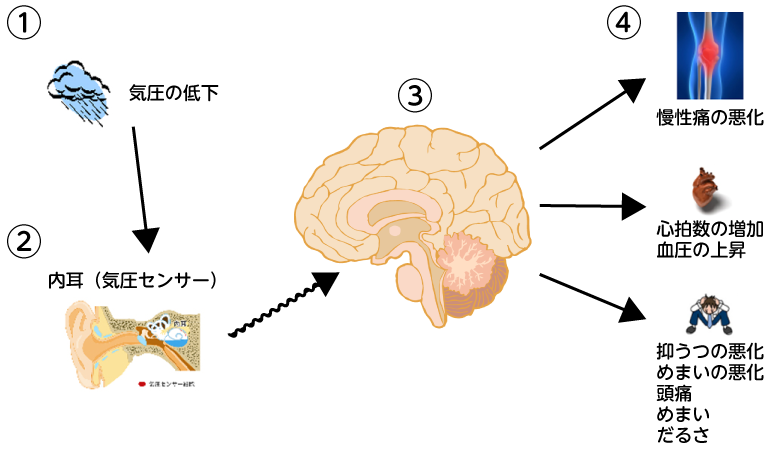 天気痛のメカニズム